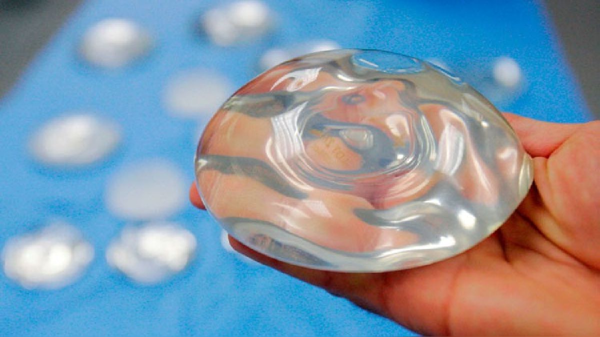 Lee más sobre el artículo Cirugía plástica: ¿Debo cambiar mis implantes de mama cada 10 años?