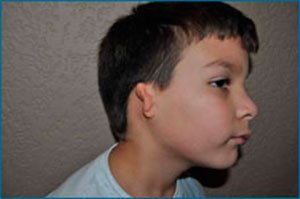 cirugia reconstructiva de orejas