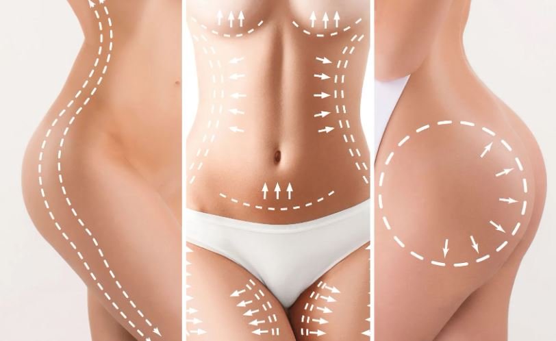 Lee más sobre el artículo El avance definitivo en la técnica de la lipoescultura