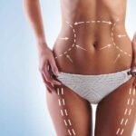 La última encuesta mundial de ISAPS revela un aumento significativo de la cirugía estética en todo el mundo