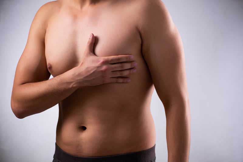 Lee más sobre el artículo Senos en los hombres: causas y cómo saber si es ginecomastia o grasa